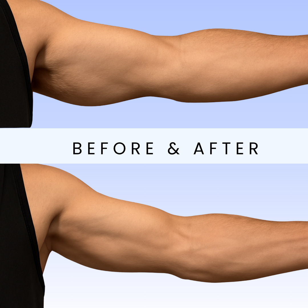 FlexBar