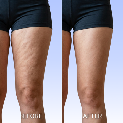 Fascia Sculpting Blade